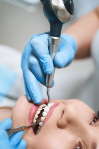 Sealants