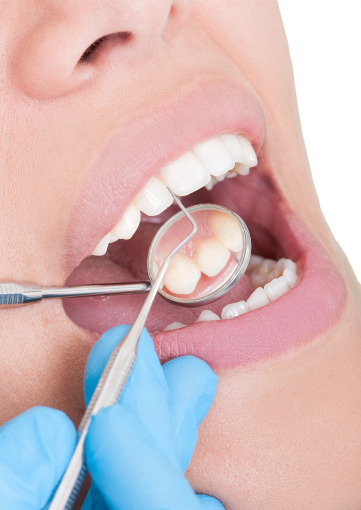 dental cleaning during chemotherapy